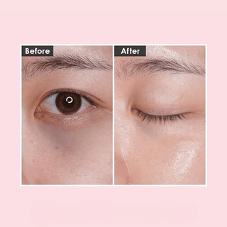 MEDIPEEL HYALURON ROSE PEPTIDE9 AMPOULE EYE PATCH Kimochi