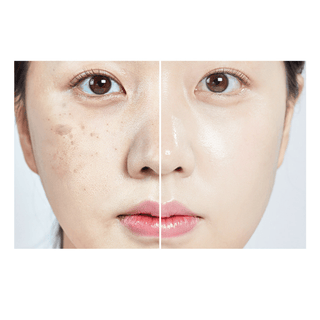 MEDIPEEL MELANON X CREAM Kimochi